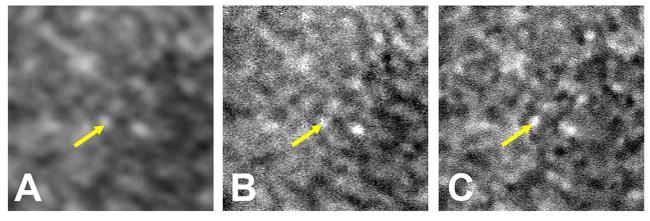 3 slides of retina tissue taken using three separate imaging techniques. Each image gets progressively clearer.