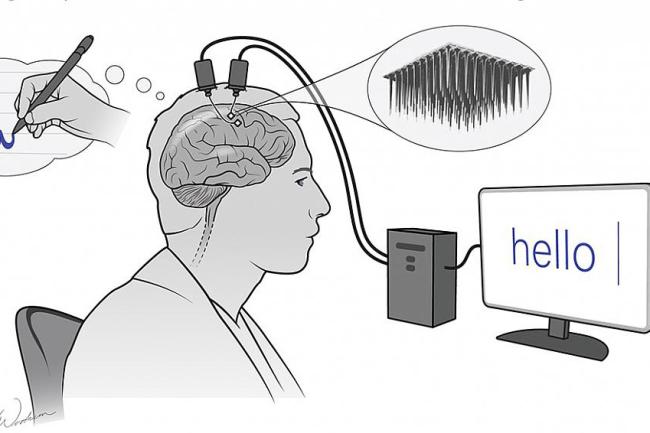 Cartoon of man thinking about writing a sentence while electrodes implanted into his brain send a signal that appears as words on a computer screen