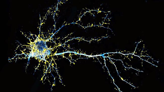 Fluorescence microscopy image of a cortical neuron.