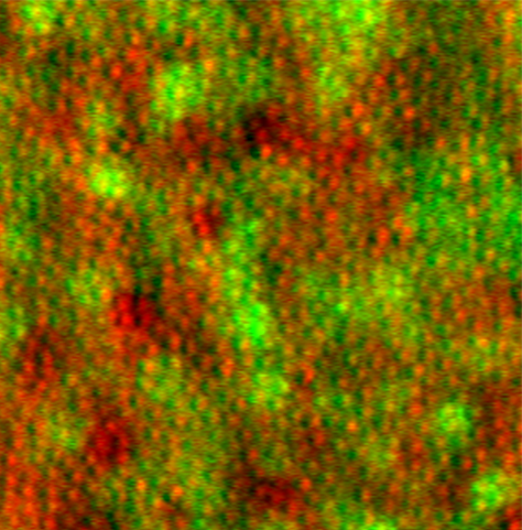 Photoreceptor cells (red) and supportive retinal pigment epithelial cells (green), imaged in a living human eye using adaptive optics