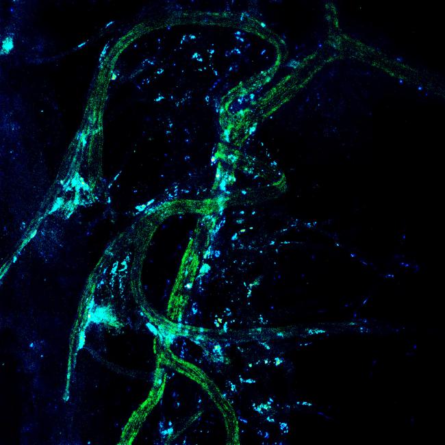 Confocal microscopy image shows Treg cells clustered next to long nerve cells.