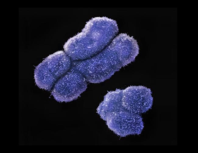 X and Y chromosomes.