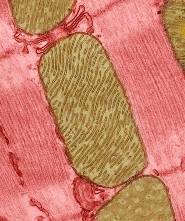 Mitochondria from rat heart muscle cell.