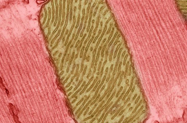 Mitochondria