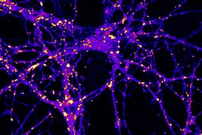 Immunofluorescence image showing bright dots throughout neurons.