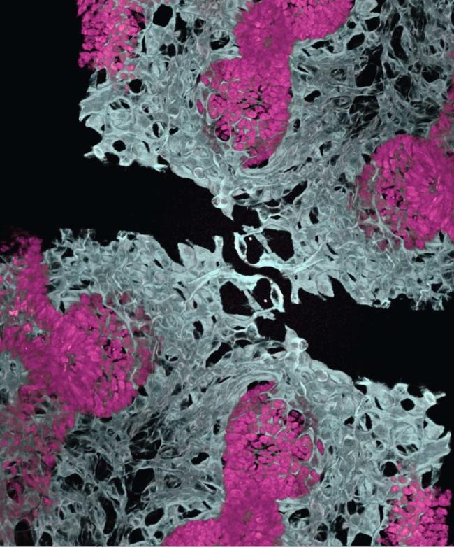 Microscope image showing six clusters of air sacs surrounded by blood vessels.