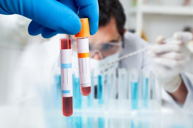 Doctor holding blood sample in test tube.