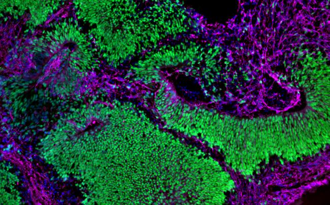 Brain organoid depicting neural stem cells (green) and neurons (magenta).