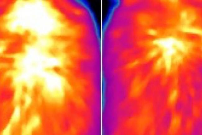 Infrared images show less heat in the brown fat of a mouse without ACOX2. 