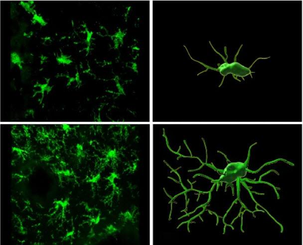 Image of cells in mouse brain. 