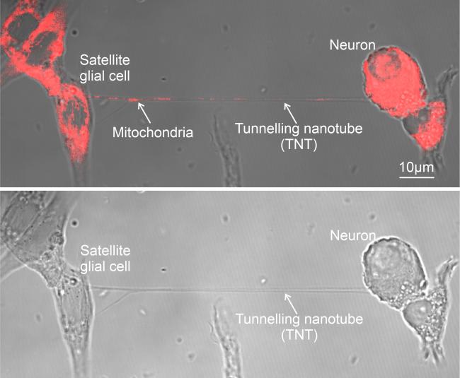 Fluorescence microscopy images show a thin nanotube connecting two cells.
