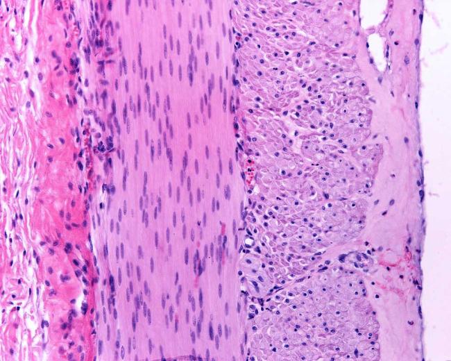 Microscope image of muscular layer of the small intestine with of two layers of smooth muscle fibers.