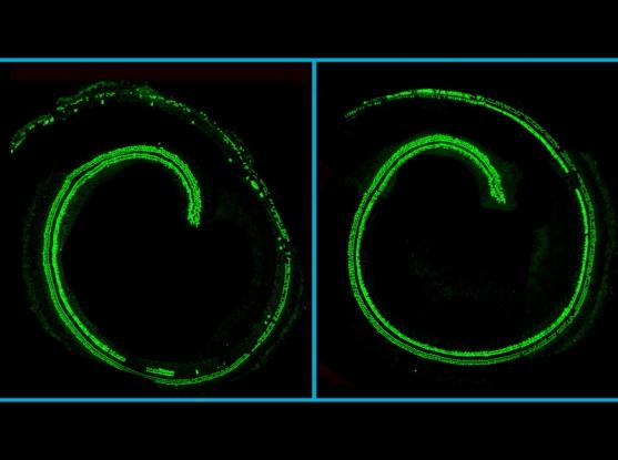 Confocal microscopy images of mouse cochlea