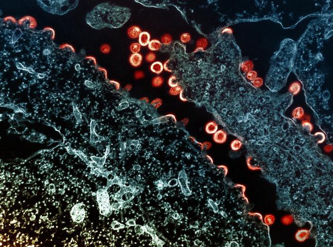 NIH-supported trial reduces HIV incidence by 70% in rural populations