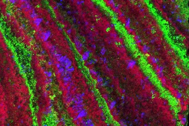  Microscopy image of a kidney stone.
