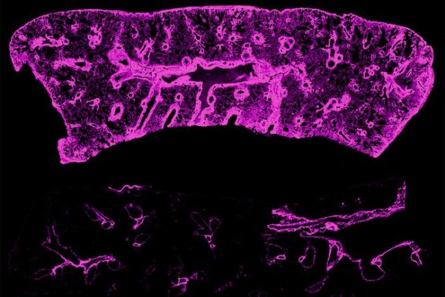 Microscope view of two transplanted mouse lungs.