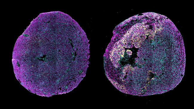 Microscope view of two newborn mouse hearts.