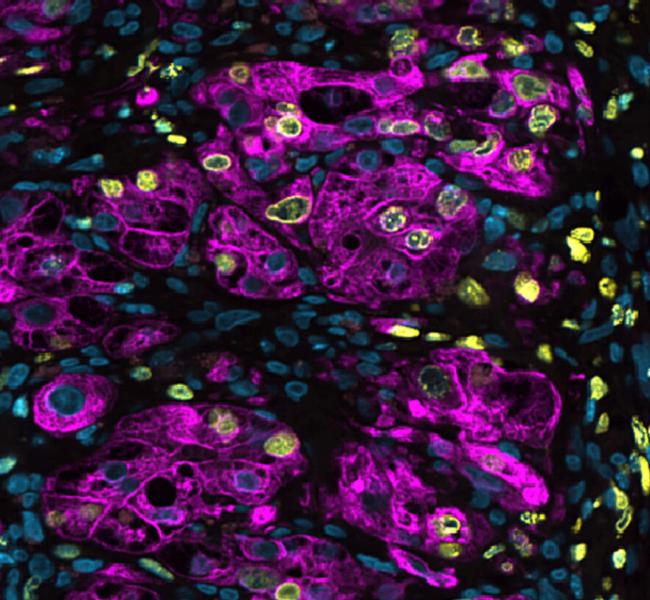 Microscope image of genetically engineered 3D liver cells. 