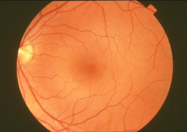 image of an eye over a neutral background