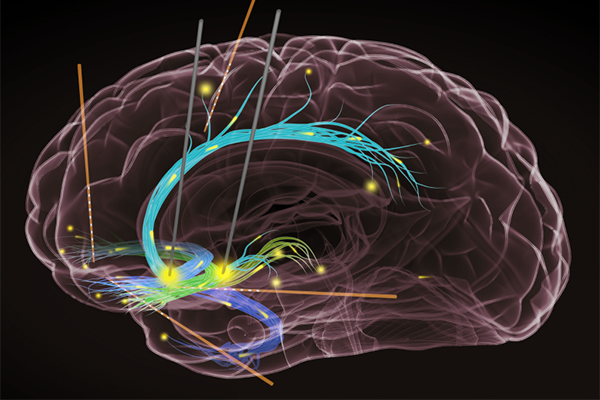 BRAIN Initiative Funding Opportunities