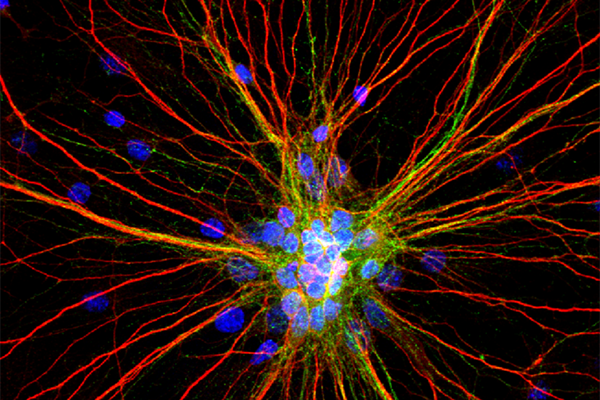 Brain Initiative Latest News