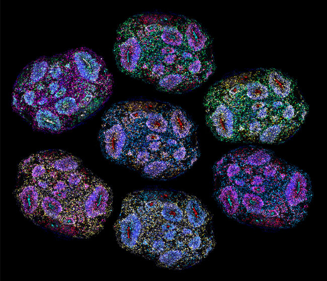 Image of multiple, colorful cross sections of the organoids arranged to almost look like fireworks.