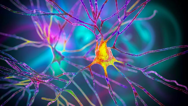 Neuron cell body (gold) with dendrites (purple).