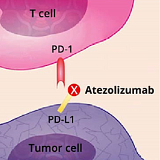 Graphic showing how atezolizumab blocks tumor cells' ablity to evade the immune system by blocking the binding of two checkpoint inhibitors, PD-1 and PD-L1.