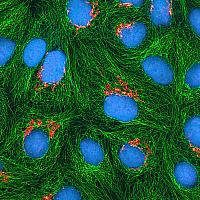 Image showing cells stained to illustrate the Golgi apparatus, the microtubules and DNA.