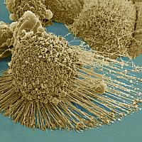 Microscopic image of a cell.