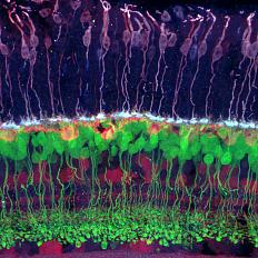 Ganglion cells, bipolar cells and photoreceptors.