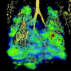 Novel Multimodality Imaging Approaches to Target Metastatic Cancers