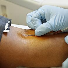 Close-up of a needle being inserted into a patient's arm.