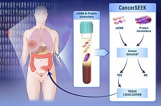 CancerSEEK is an experimental blood test that detects and localizes eight common cancer types. 