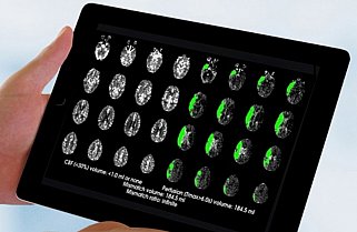 A tablet screen showing multiple brain perfusion scans 