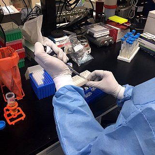 Neural cells infected with Zika virus