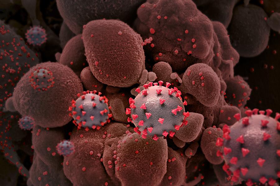 Creative rendition of SARS-COV-2 virus particles.