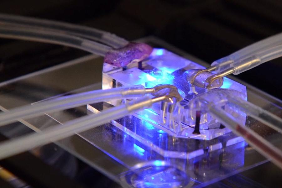 Lung-on-a-chip.  