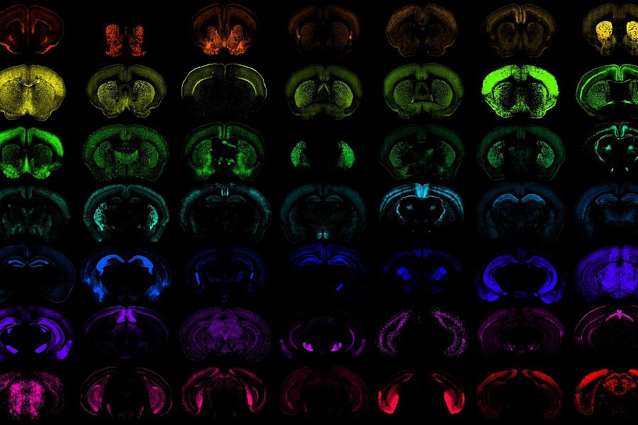 Multiple images of the mouse brain on a black background with various cells highlighted to portray the precision access of new genetic tools developed. 
