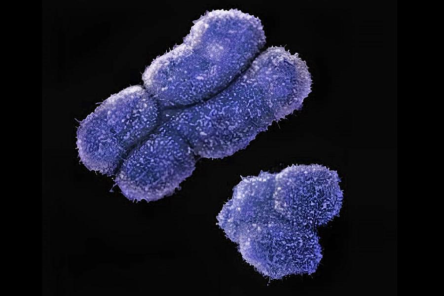 X and Y chromosomes.