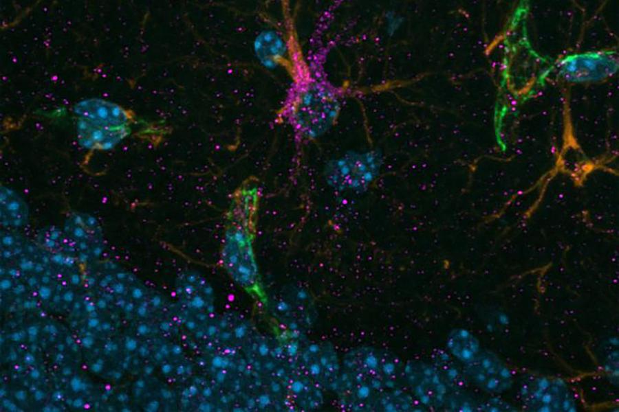Astrocytes.