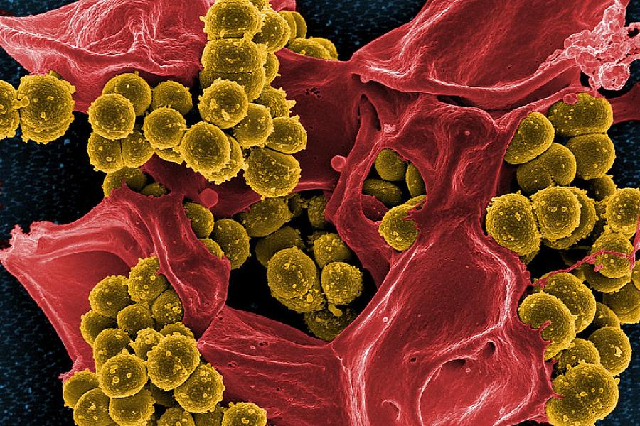 Colorized scanning electron micrograph of methicillin-resistant Staphylococcus aureus (MRSA) bacteria (gold) interacting with a human neutrophil (red). Image captured at NIAID's Rocky Mountain Laboratories (RML) in Hamilton, Montana.