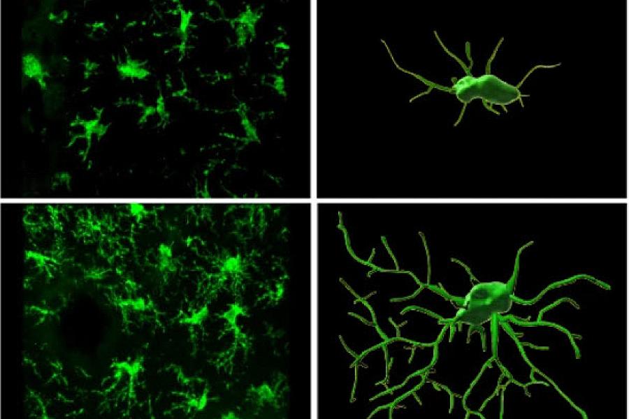 Image of cells in mouse brain. 