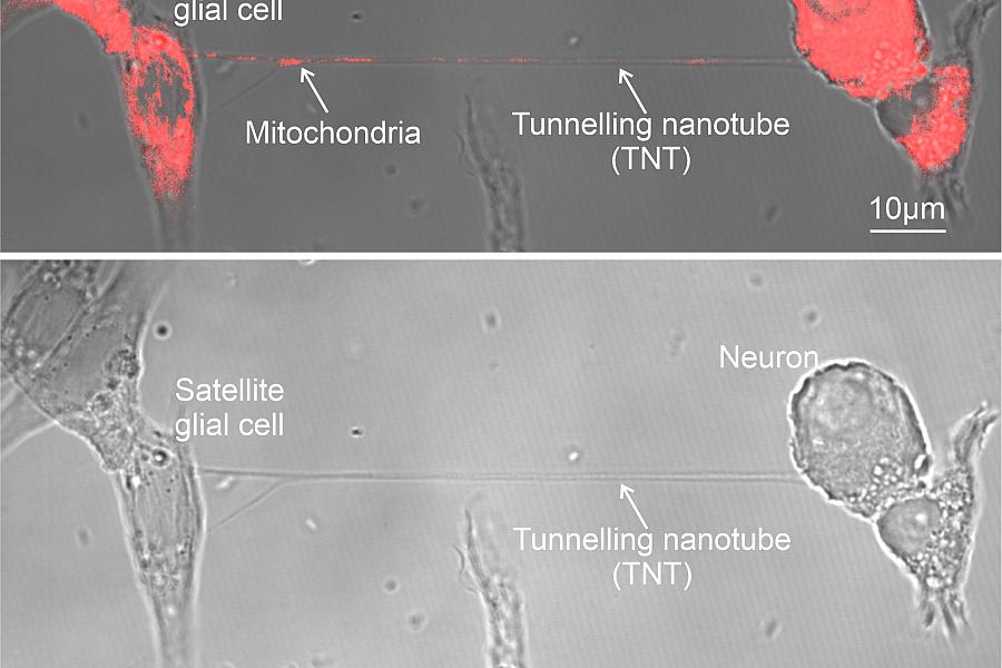 Images showing cells and tunnelling nanotube prior to and after mitochondrial transfer. After image has red coloring to show successful transfer.