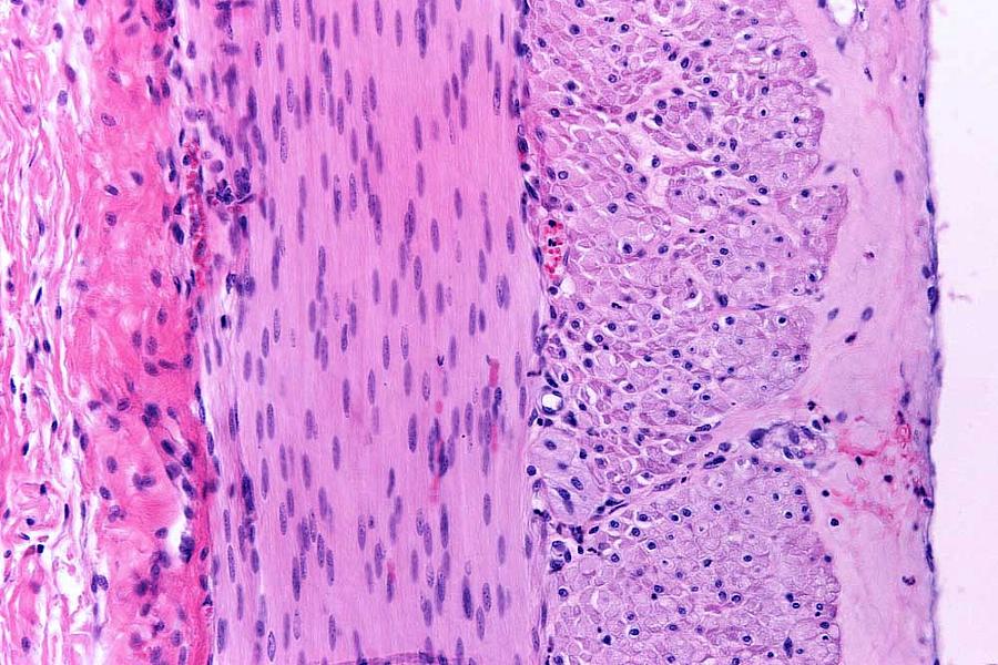 Microscope image of muscular layer of the small intestine with of two layers of smooth muscle fibers.