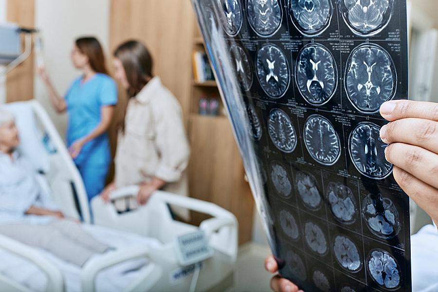 Image of a cranial MRI sheet being held by a medical professional with an older women in a hospital bed in the background.