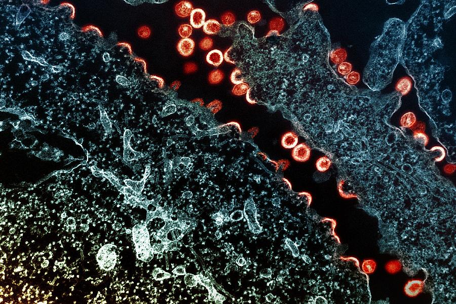 Transmission electron micrograph of HIV-1 virus particles (red/yellow) budding and replicating from a segment of a chronically infected H9 cell (blue/teal). 