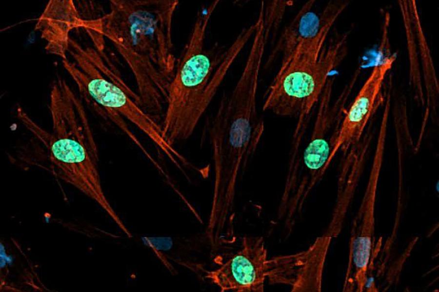 Multiplying fibroblasts