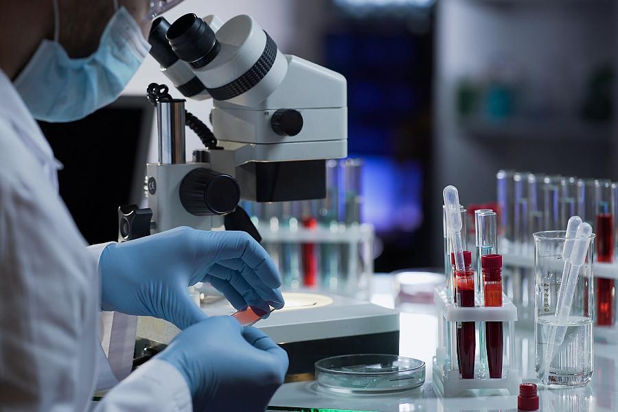 A scientist works with a microscope slide with a blood smear on it.