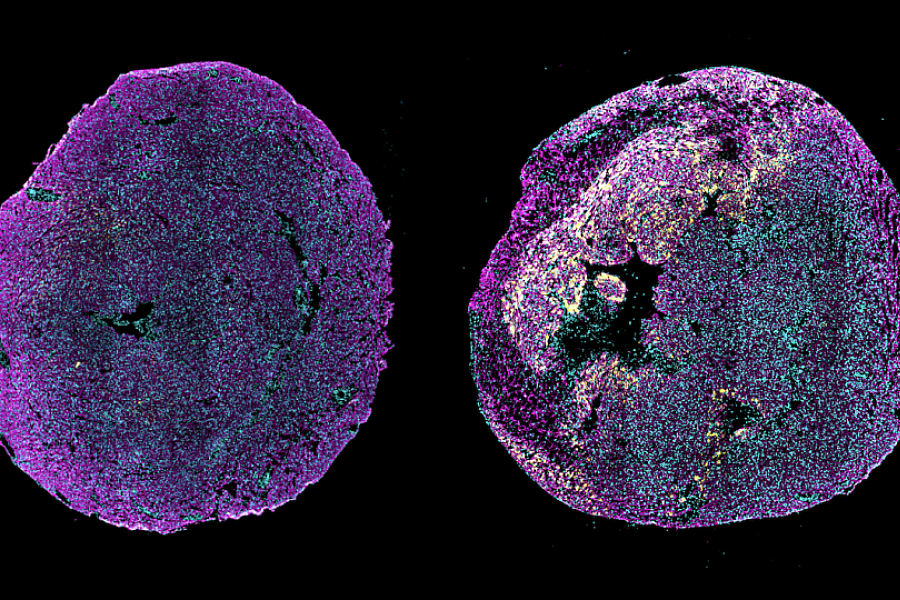 Microscope view of two newborn mouse hearts.